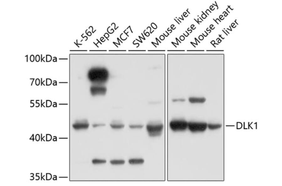 Western Blot - Anti-DLK-1 Antibody (A14149) - Antibodies.com