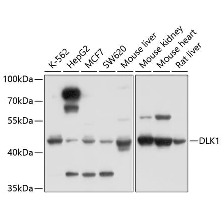 Western Blot - Anti-DLK-1 Antibody (A14149) - Antibodies.com