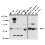 Western Blot - Anti-DLK-1 Antibody (A14149) - Antibodies.com