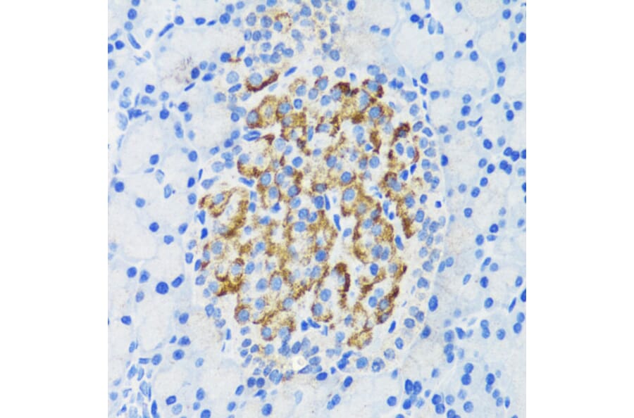 Immunohistochemistry - Anti-DLK-1 Antibody (A14149) - Antibodies.com