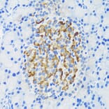 Immunohistochemistry - Anti-DLK-1 Antibody (A14149) - Antibodies.com