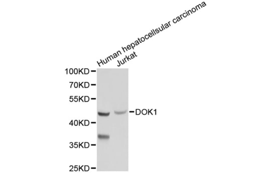 Western Blot - Anti-DOK1 Antibody (A2717) - Antibodies.com
