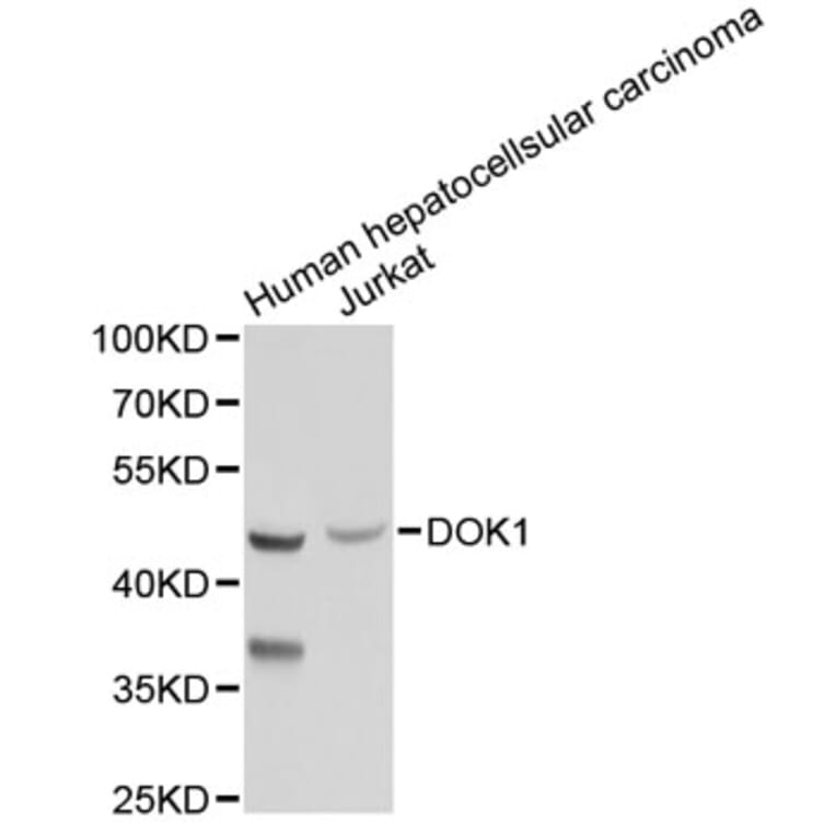 Western Blot - Anti-DOK1 Antibody (A2717) - Antibodies.com