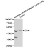 Western Blot - Anti-DOK1 Antibody (A2717) - Antibodies.com