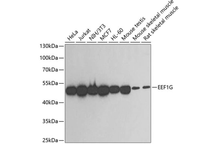 Western Blot - Anti-EEF1G Antibody (A2721) - Antibodies.com