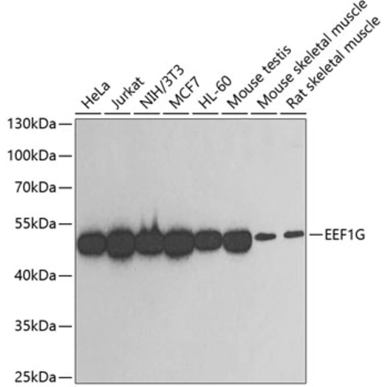 Western Blot - Anti-EEF1G Antibody (A2721) - Antibodies.com