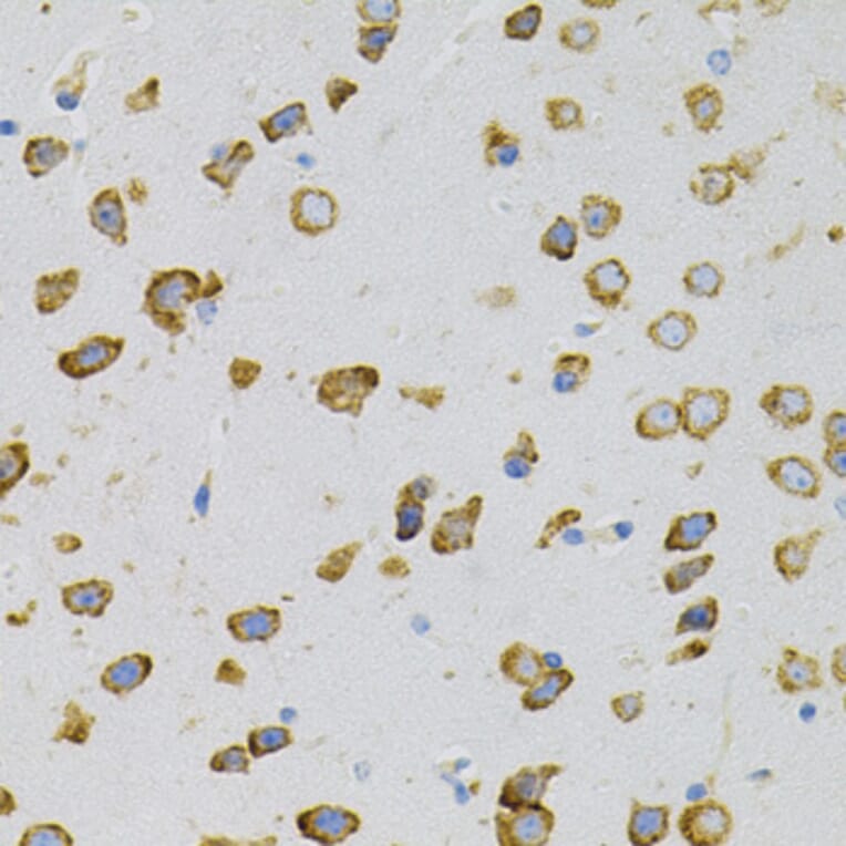 Immunohistochemistry - Anti-EEF1G Antibody (A2721) - Antibodies.com