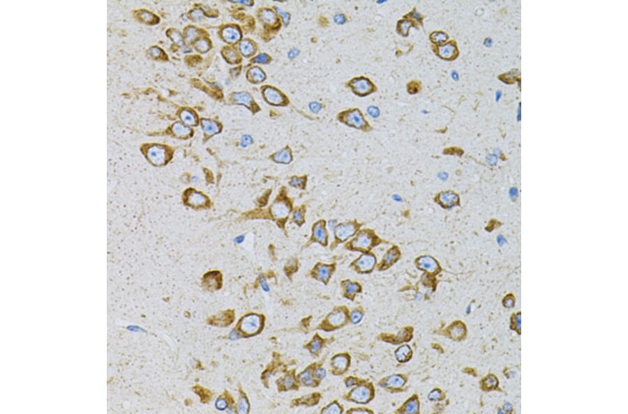 Immunohistochemistry - Anti-EEF1G Antibody (A2721) - Antibodies.com