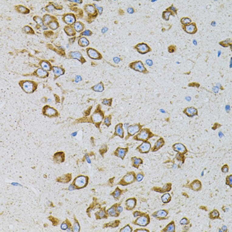 Immunohistochemistry - Anti-EEF1G Antibody (A2721) - Antibodies.com