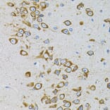 Immunohistochemistry - Anti-EEF1G Antibody (A2721) - Antibodies.com
