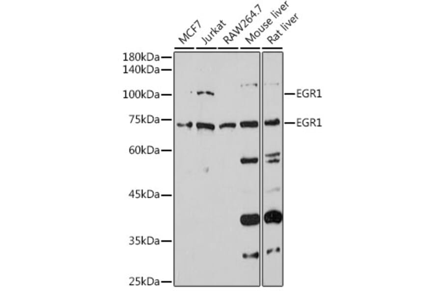 Western Blot - Anti-Egr1 Antibody (A14152) - Antibodies.com