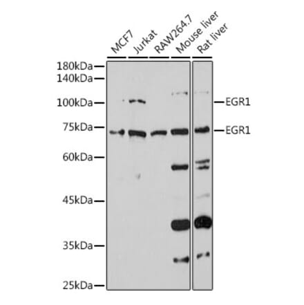 Western Blot - Anti-Egr1 Antibody (A14152) - Antibodies.com