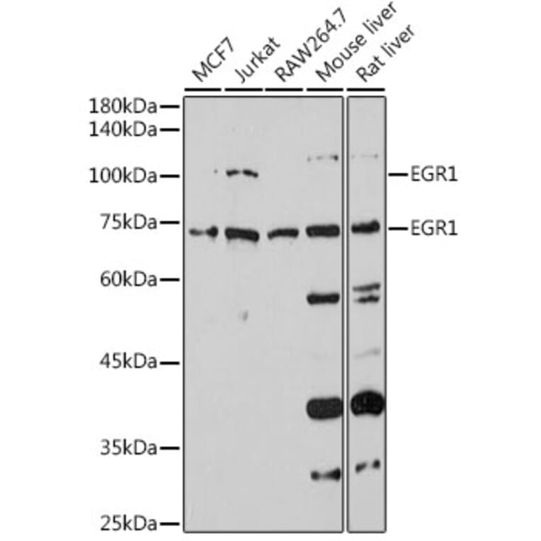 Western Blot - Anti-Egr1 Antibody (A14152) - Antibodies.com