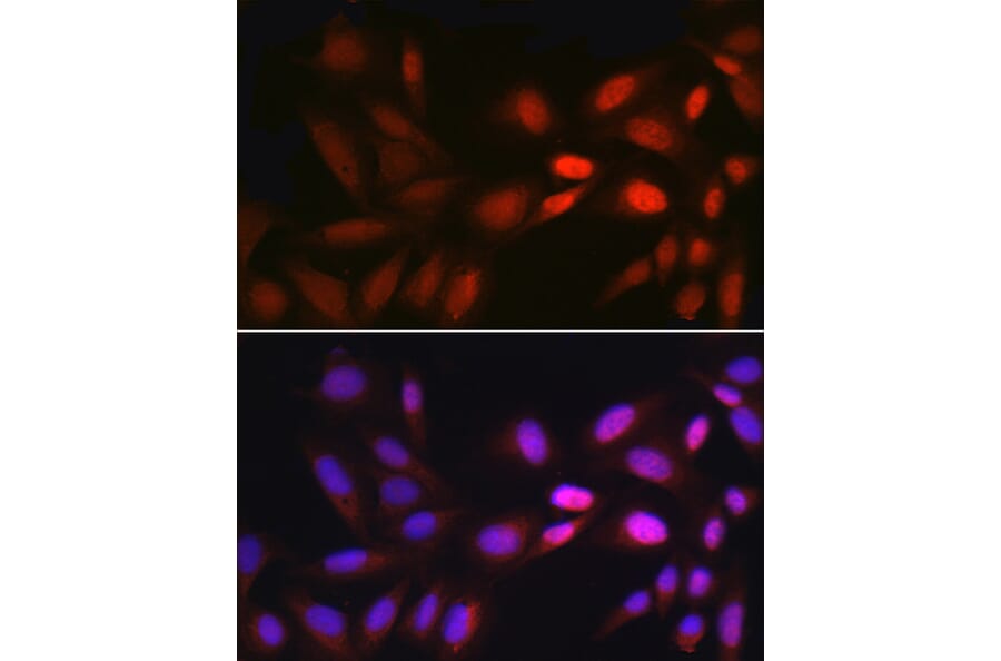 Immunofluorescence - Anti-Egr1 Antibody (A14152) - Antibodies.com