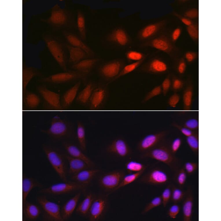Immunofluorescence - Anti-Egr1 Antibody (A14152) - Antibodies.com