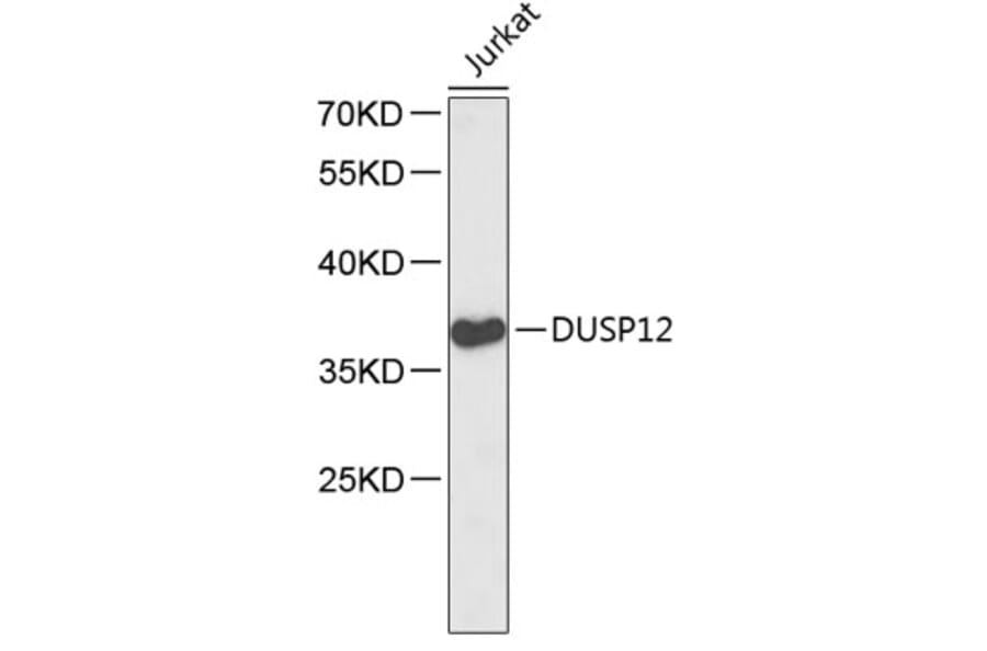 Western Blot - Anti-DUSP12 Antibody (A2725) - Antibodies.com