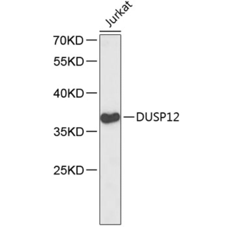 Western Blot - Anti-DUSP12 Antibody (A2725) - Antibodies.com