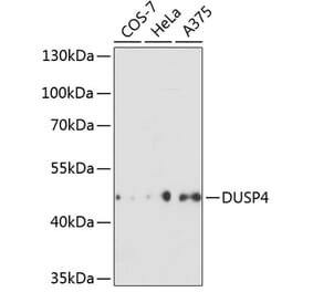Western Blot - Anti-DUSP4 Antibody (A14154) - Antibodies.com