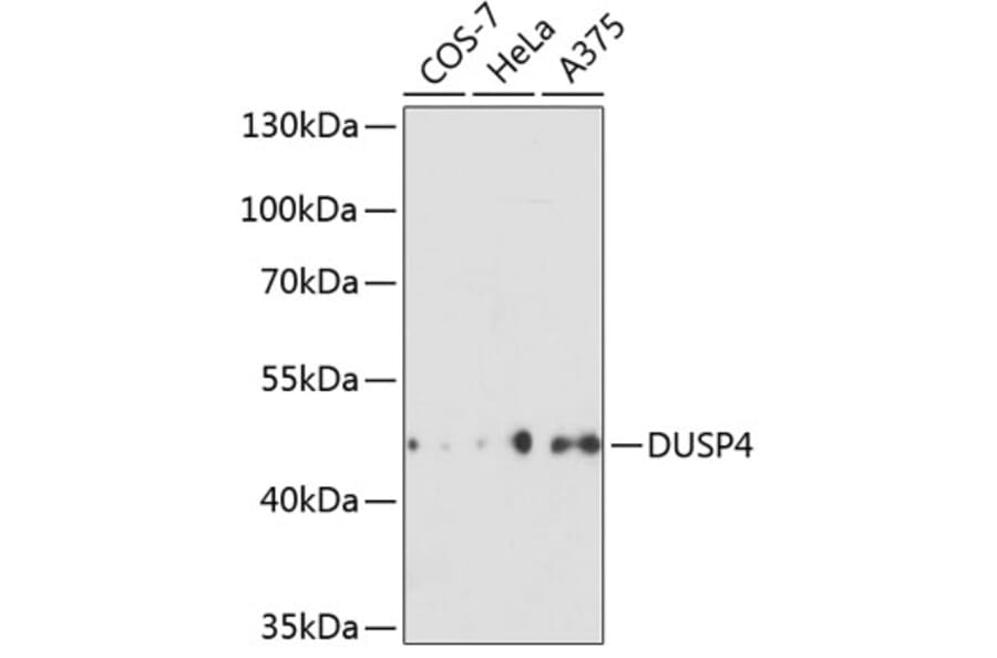 Western Blot - Anti-DUSP4 Antibody (A14154) - Antibodies.com