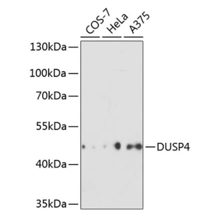 Western Blot - Anti-DUSP4 Antibody (A14154) - Antibodies.com