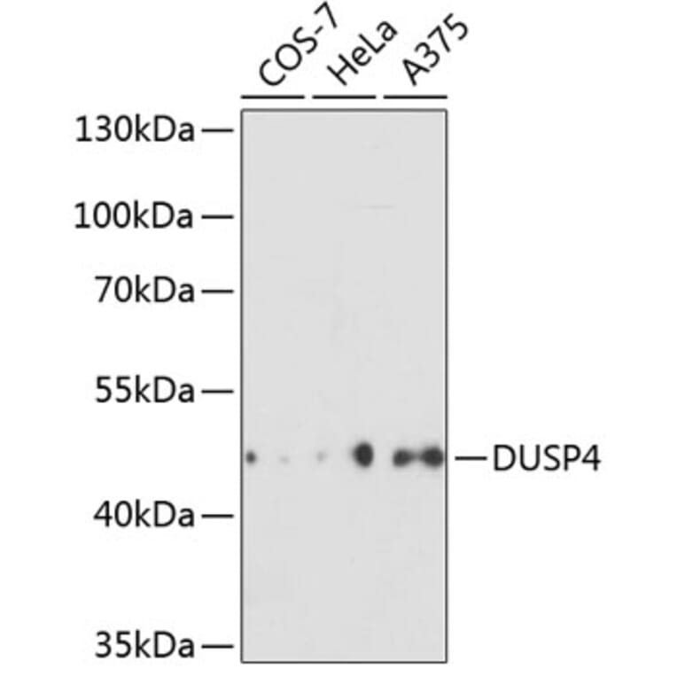 Western Blot - Anti-DUSP4 Antibody (A14154) - Antibodies.com