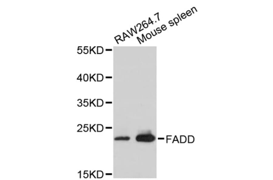 Western Blot - Anti-FADD Antibody (A2728) - Antibodies.com