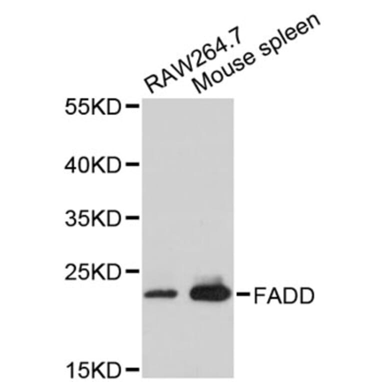 Western Blot - Anti-FADD Antibody (A2728) - Antibodies.com