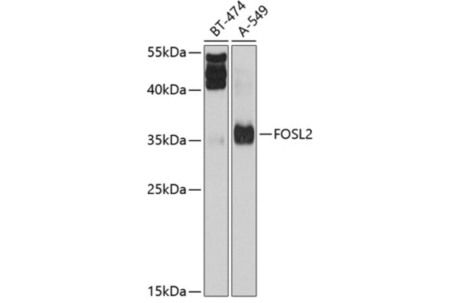 Western Blot - Anti-FRA2 Antibody (A14157) - Antibodies.com