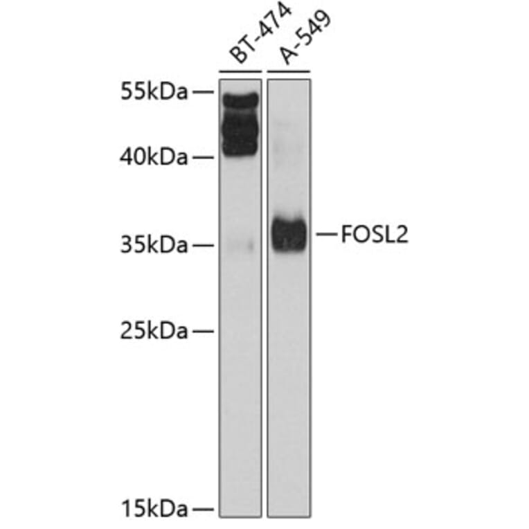 Western Blot - Anti-FRA2 Antibody (A14157) - Antibodies.com