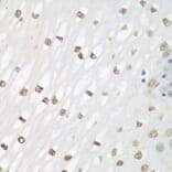 Immunohistochemistry - Anti-FRA2 Antibody (A14157) - Antibodies.com