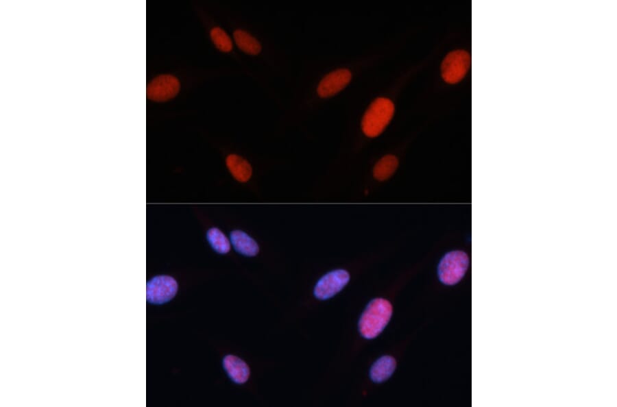 Immunofluorescence - Anti-FRA2 Antibody (A14157) - Antibodies.com