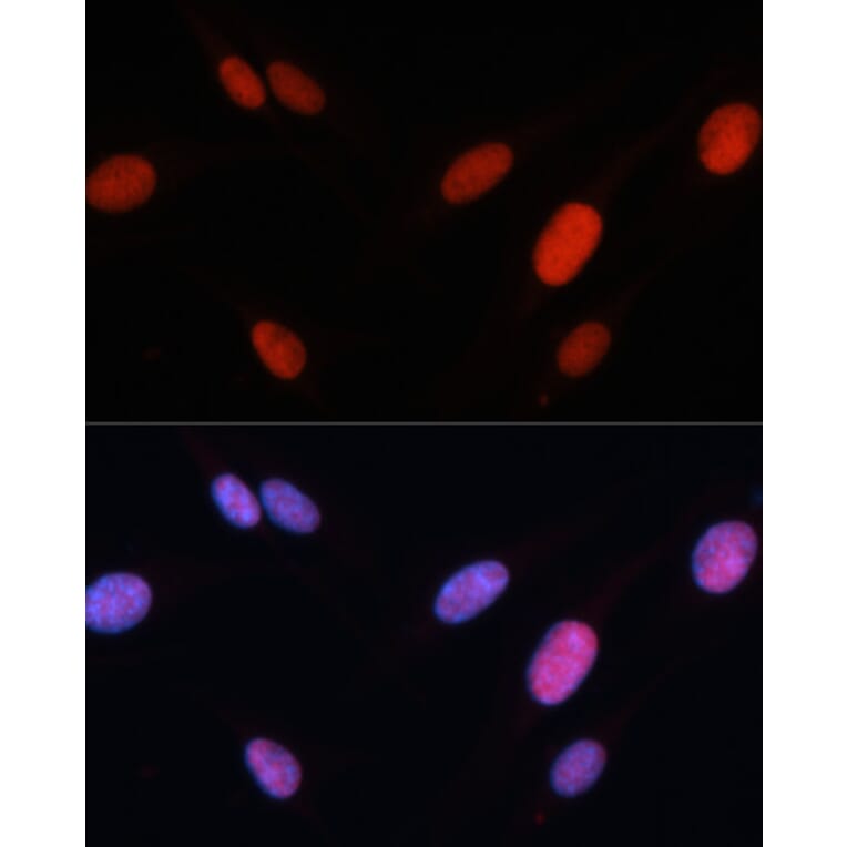 Immunofluorescence - Anti-FRA2 Antibody (A14157) - Antibodies.com