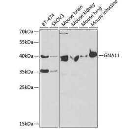 Western Blot - Anti-GNA11 Antibody (A14158) - Antibodies.com