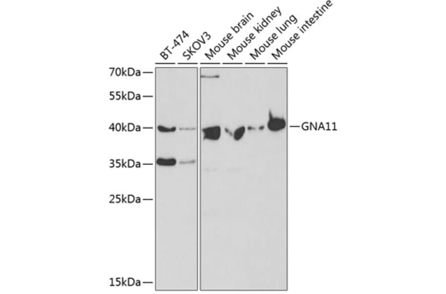 Western Blot - Anti-GNA11 Antibody (A14158) - Antibodies.com