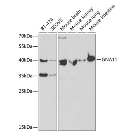 Western Blot - Anti-GNA11 Antibody (A14158) - Antibodies.com
