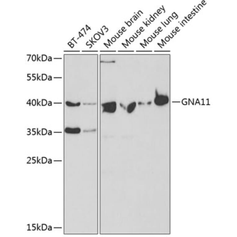 Western Blot - Anti-GNA11 Antibody (A14158) - Antibodies.com