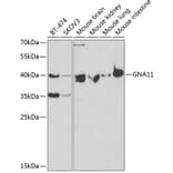 Western Blot - Anti-GNA11 Antibody (A14158) - Antibodies.com