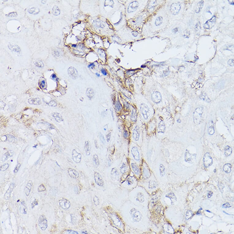 Immunohistochemistry - Anti-GNA11 Antibody (A14158) - Antibodies.com