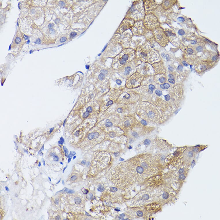 Immunohistochemistry - Anti-GNA11 Antibody (A14158) - Antibodies.com