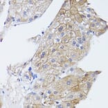 Immunohistochemistry - Anti-GNA11 Antibody (A14158) - Antibodies.com