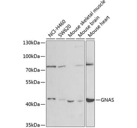 Western Blot - Anti-GNAS Antibody (A14159) - Antibodies.com
