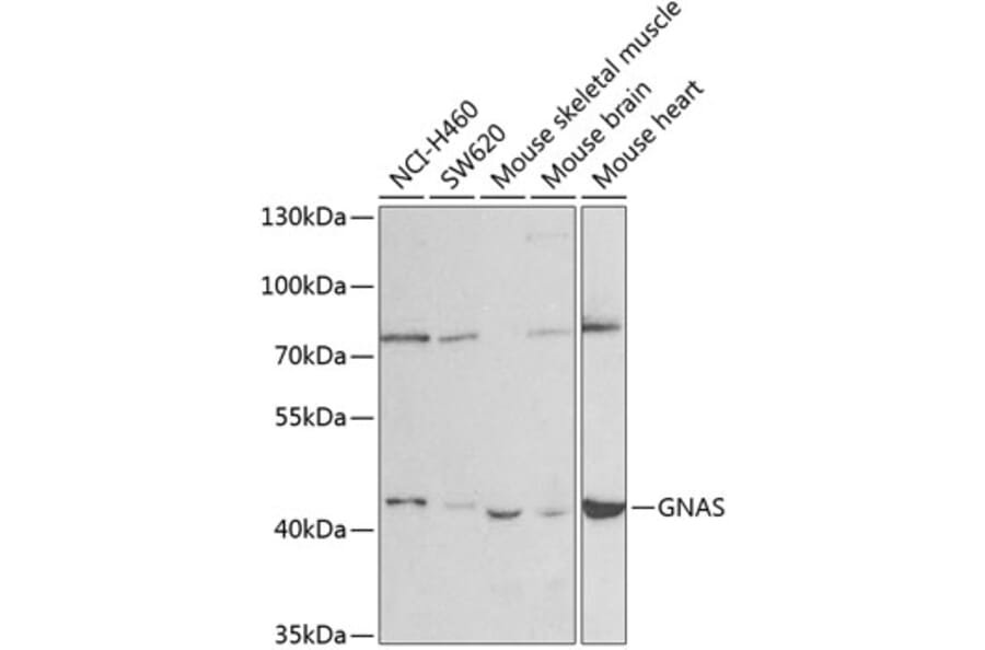 Western Blot - Anti-GNAS Antibody (A14159) - Antibodies.com