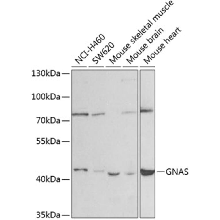 Western Blot - Anti-GNAS Antibody (A14159) - Antibodies.com