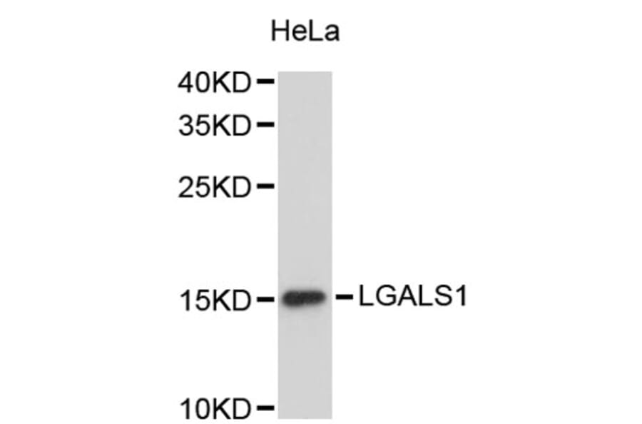Western Blot - Anti-LGALS1 Antibody (A2733) - Antibodies.com