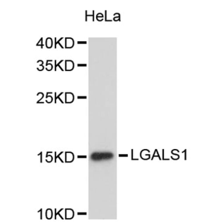 Western Blot - Anti-LGALS1 Antibody (A2733) - Antibodies.com