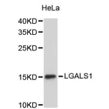 Western Blot - Anti-LGALS1 Antibody (A2733) - Antibodies.com