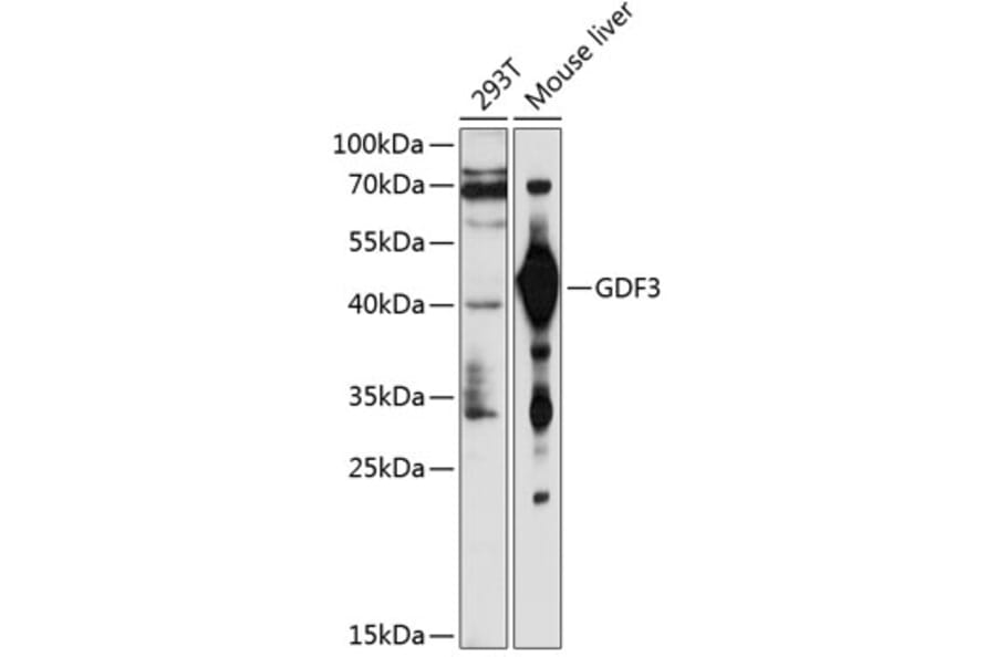 Western Blot - Anti-GDF3 Antibody (A2738) - Antibodies.com