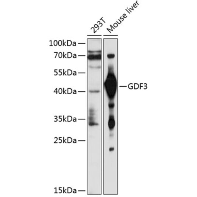 Western Blot - Anti-GDF3 Antibody (A2738) - Antibodies.com
