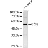 Western Blot - Anti-GDF9 Antibody (A14162) - Antibodies.com