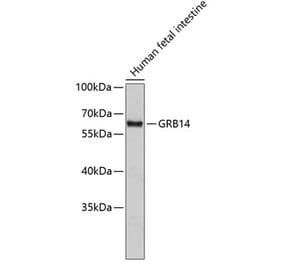 Western Blot - Anti-GRB14 Antibody (A14163) - Antibodies.com